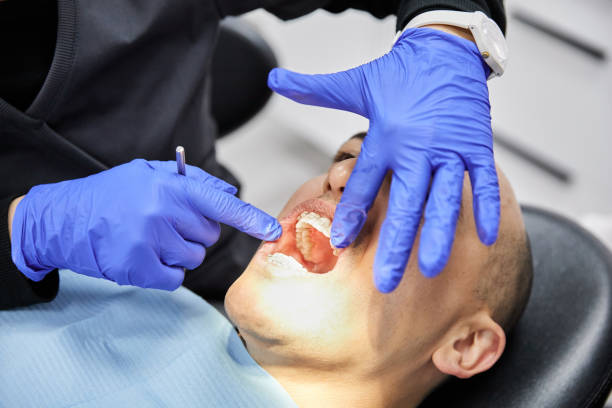Best Emergency Dental Care for Abscessed Tooth in Chelsea Cove, NY