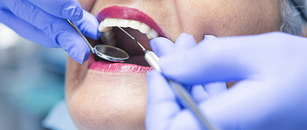 Best Emergency Dentist for Lost Fillings or Crowns in Chelsea Cove, NY